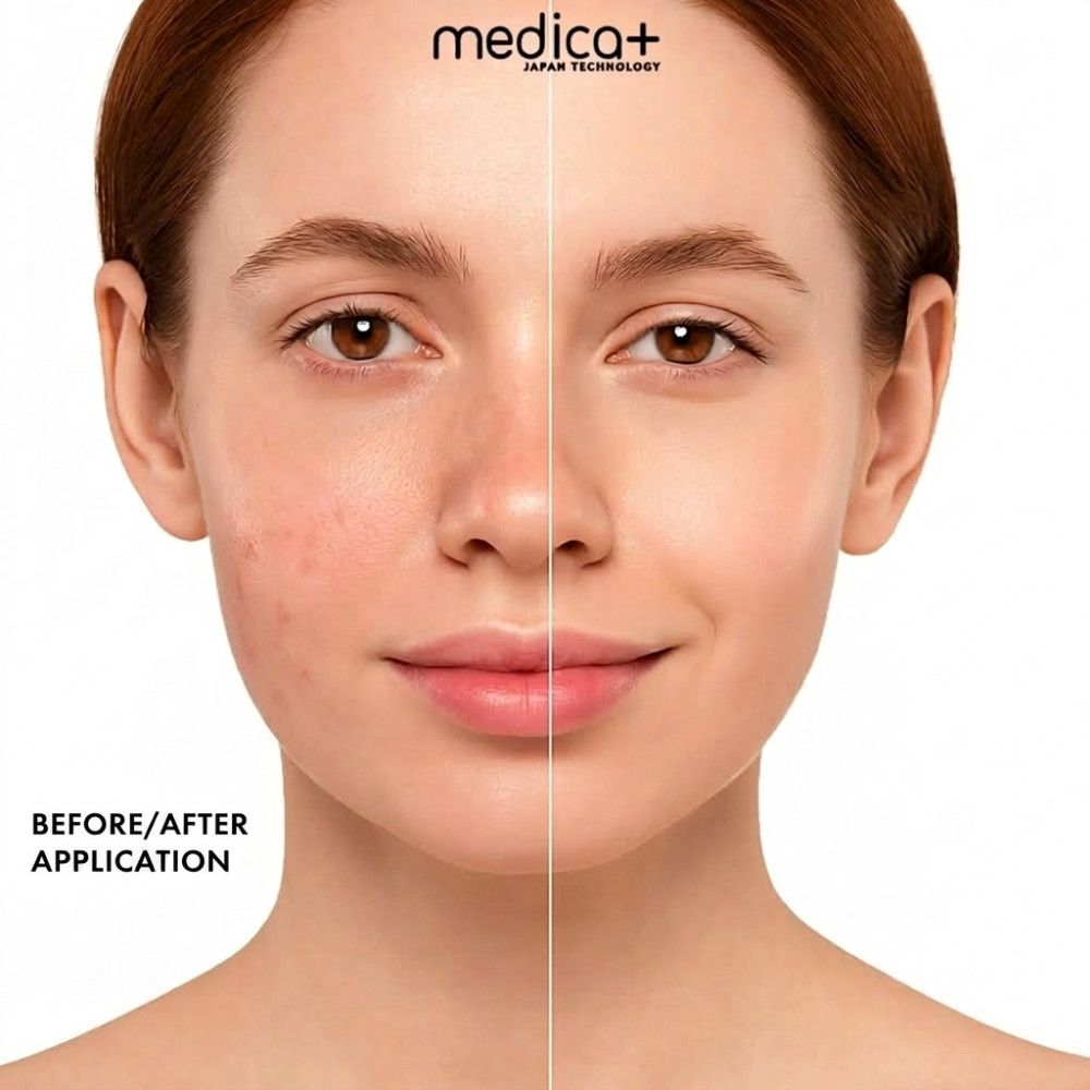 MEDICA+ LEDMask 8X LED light therapy mask (Japan)