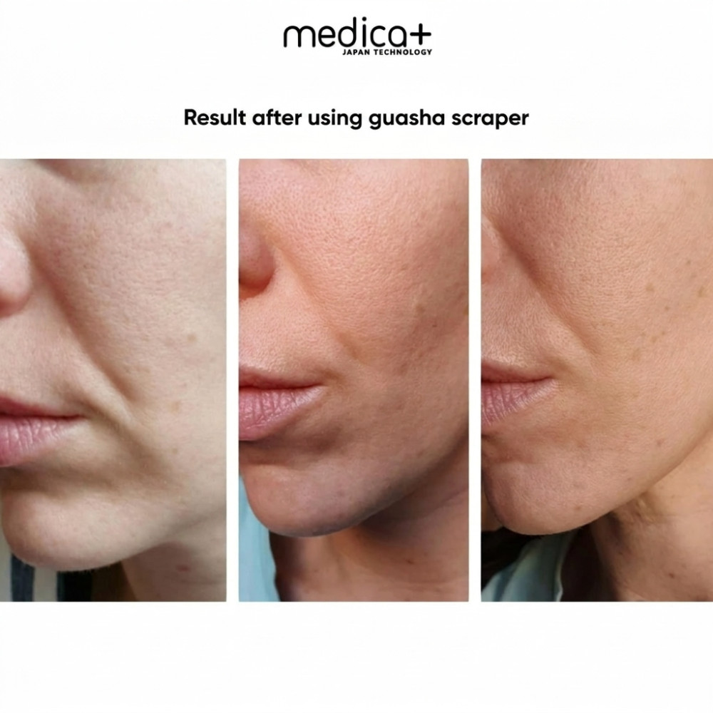 MEDICA+ Steel GuaSha facial contouring scraper